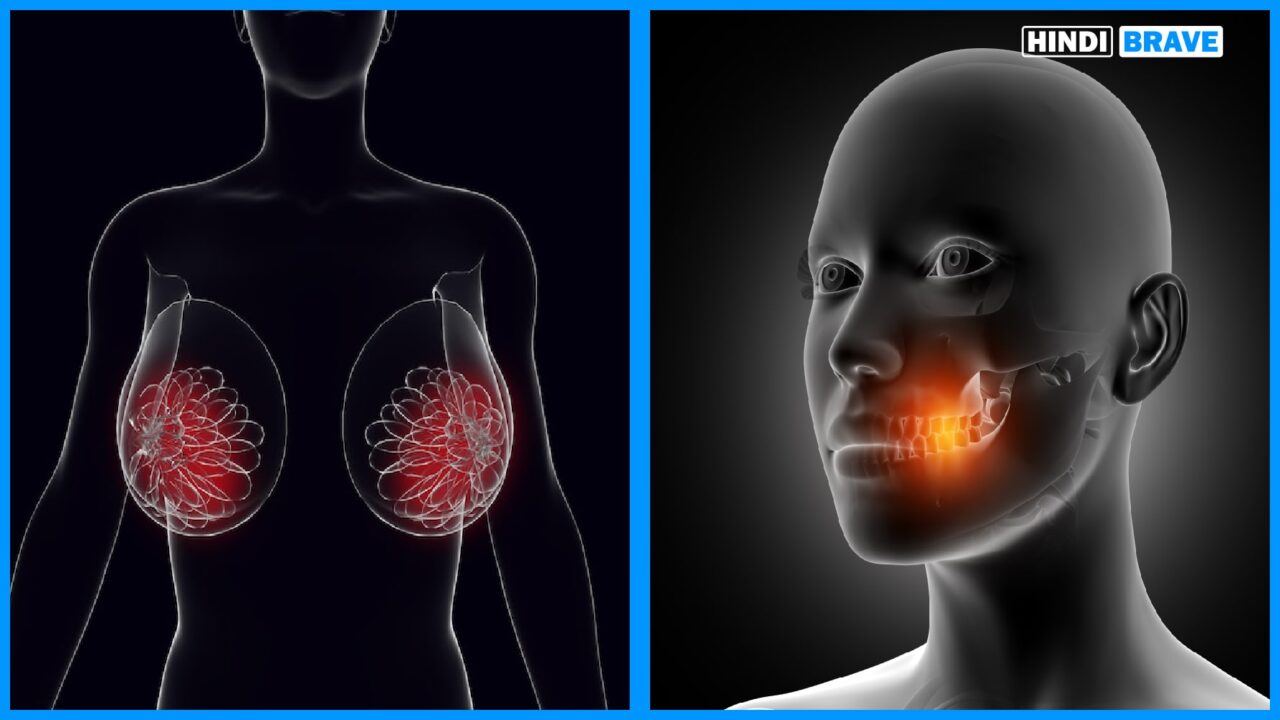 Breast And Mouth Cancers In India