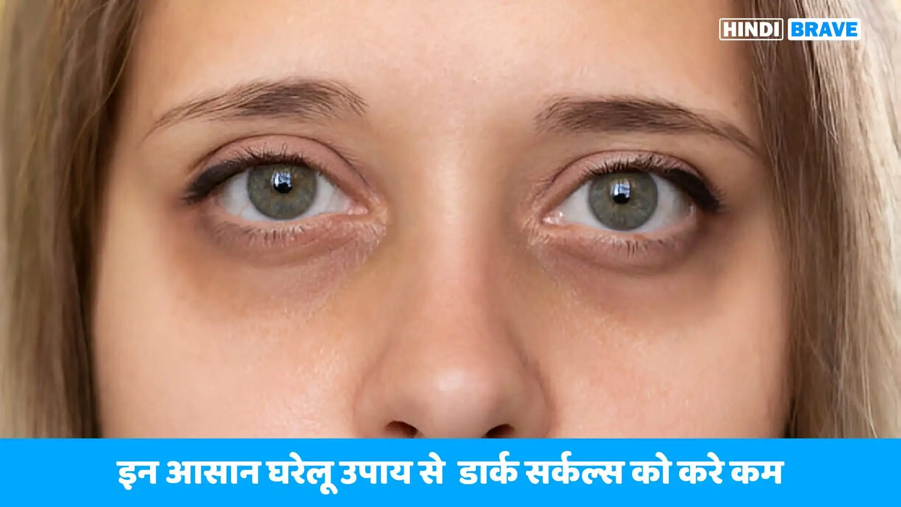 How To Cure Dark Circles Hindibrave